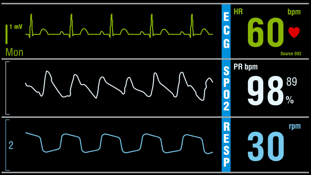 Chronic Heart Failure and Social Security Disability