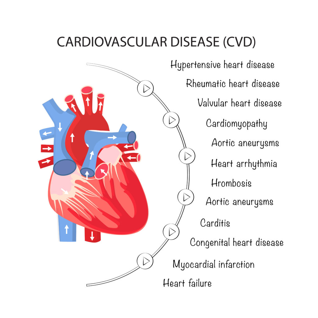 Additional Cardiovascular Conditions and Social Security Disability