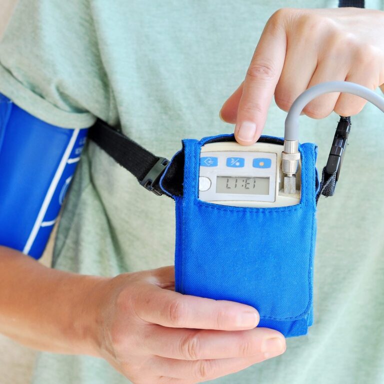 arrhythmias and social security disability