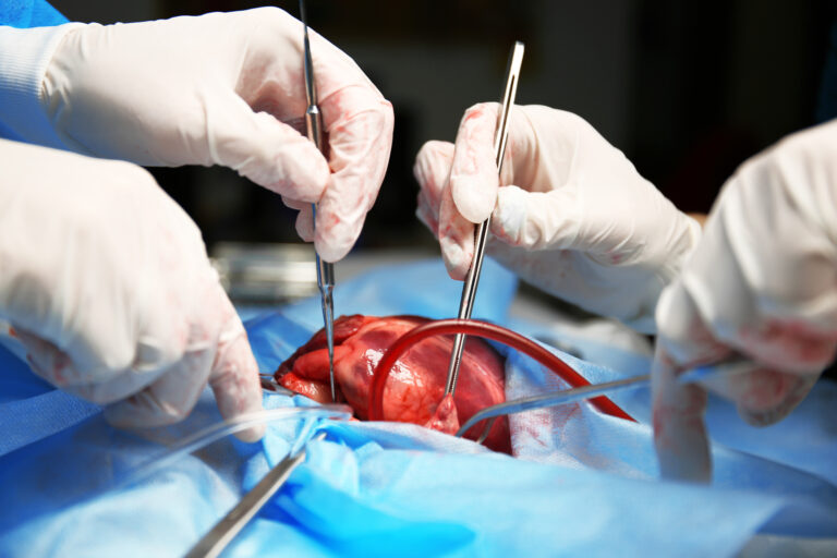 Heart Transplant and Social Security Disability
