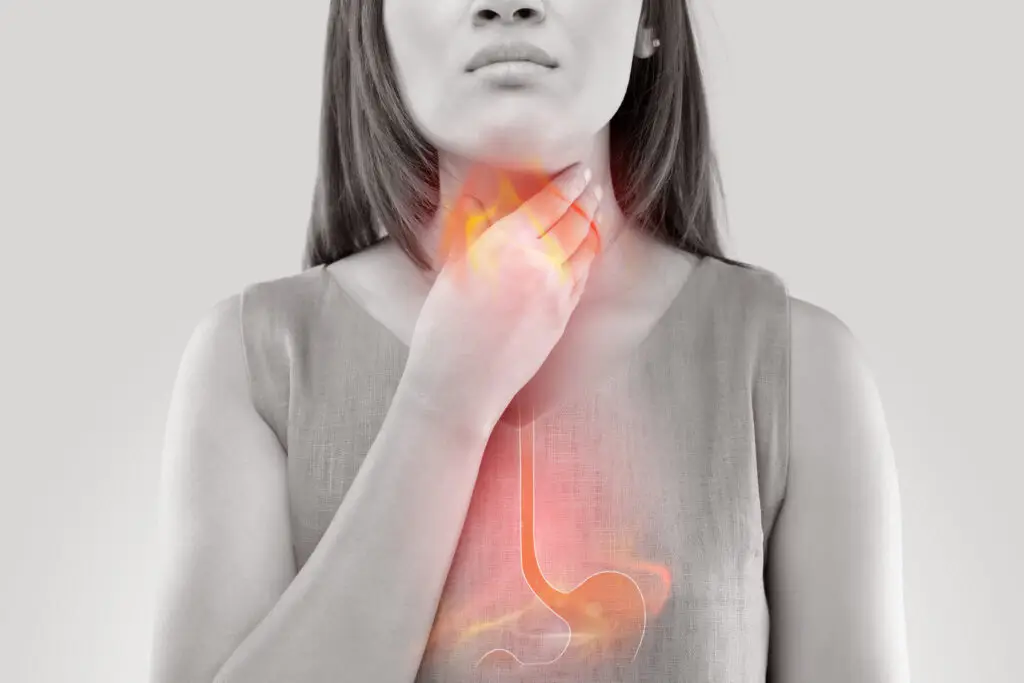 GERD and Social Security Disability