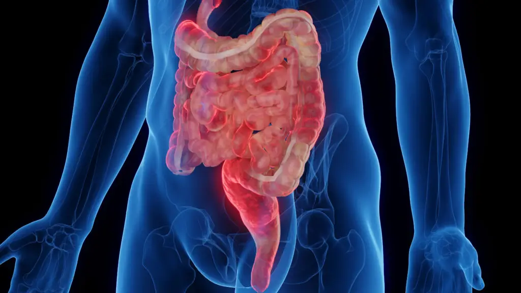 Crohn's Disease and Social Security Disability