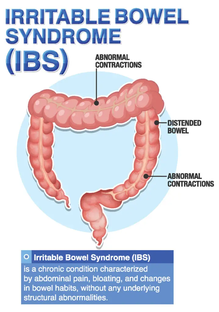IBS and Social Security Disability