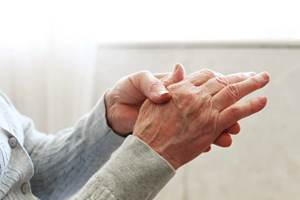 Residual Functional Capacity Rheumatoid Arthritis SSDI