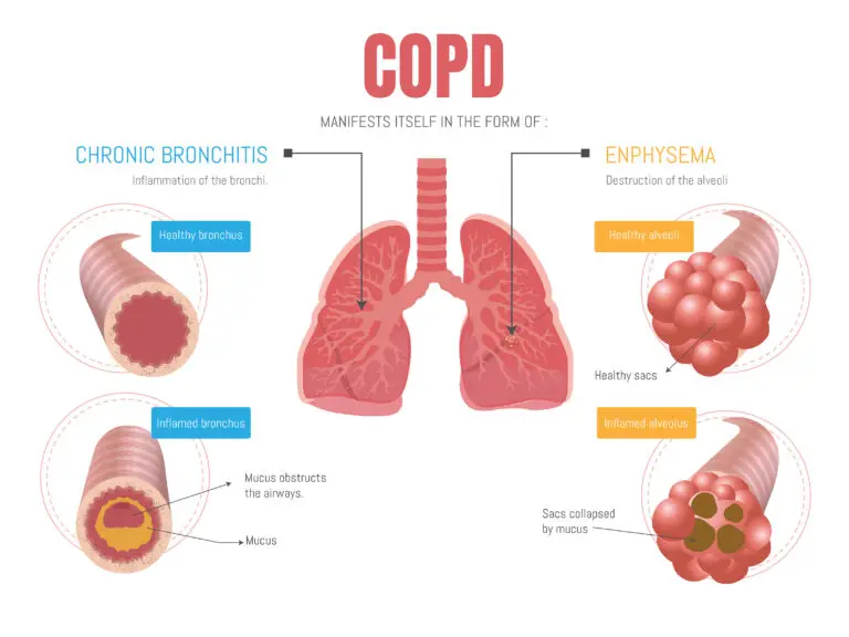 residual functional capacity for COPD