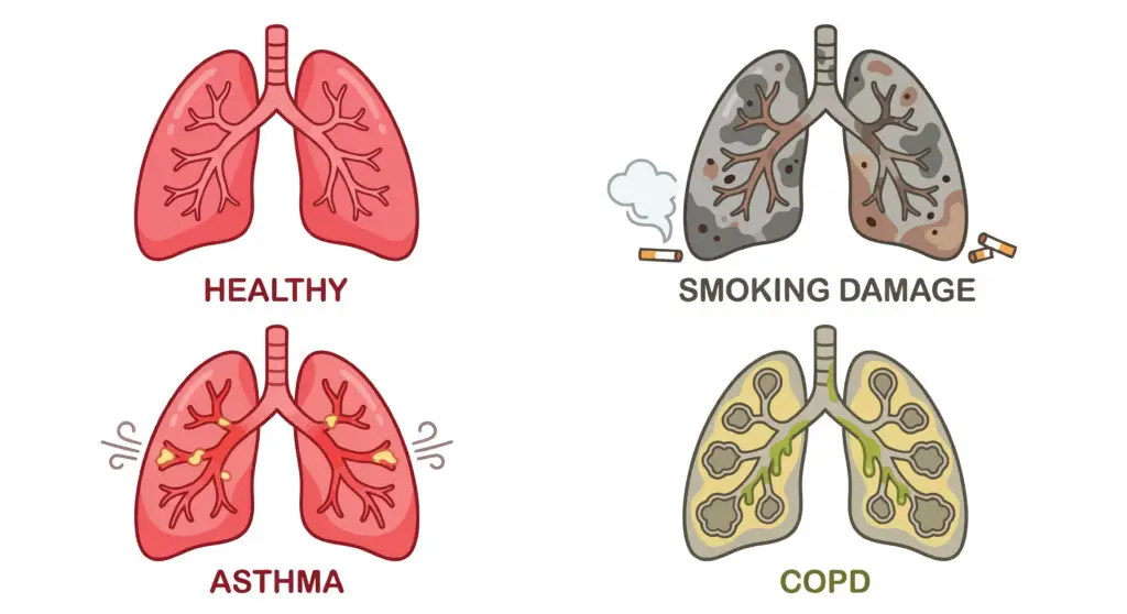 Can I Work With COPD