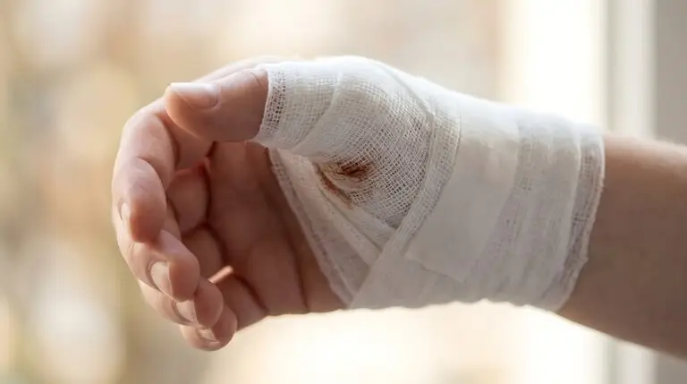 Hand and Finger Injuries in Texas Workers’ Compensation