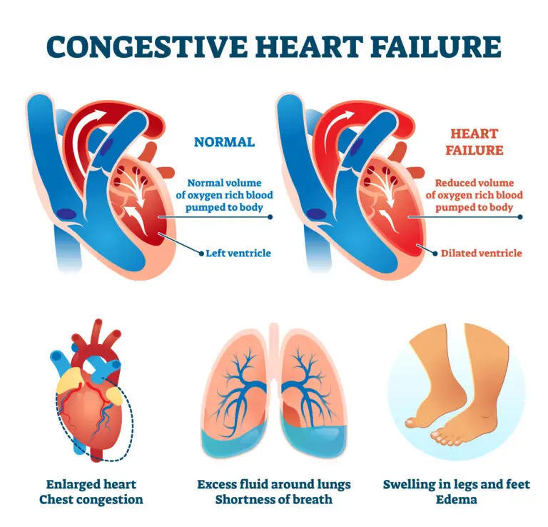 residual functional capacity for heart failure in SSDI claims