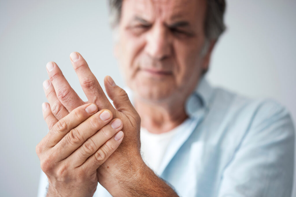 Post Traumatic Hand and Finger Arthritis in Texas Workers’ Compensation