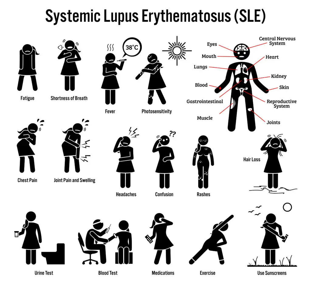 can I work with lupus