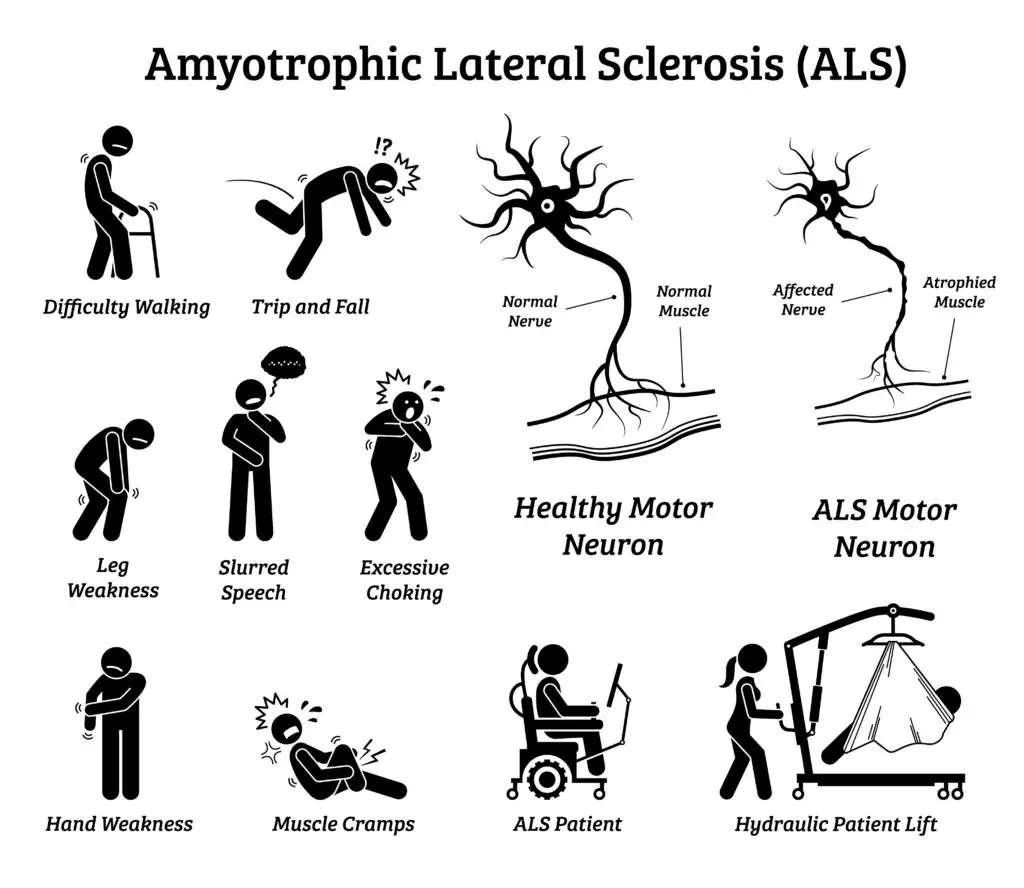 residual functional capacity for ALS