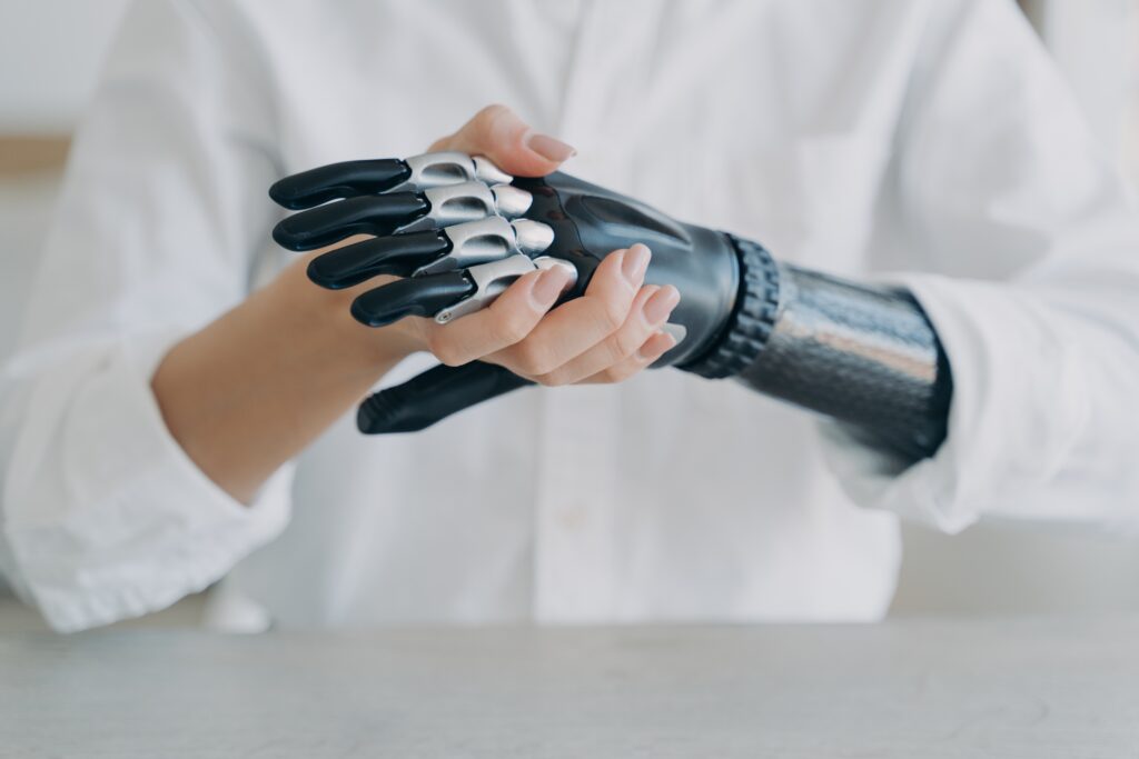 Hand and Finger Amputations in Texas Workers’ Compensation