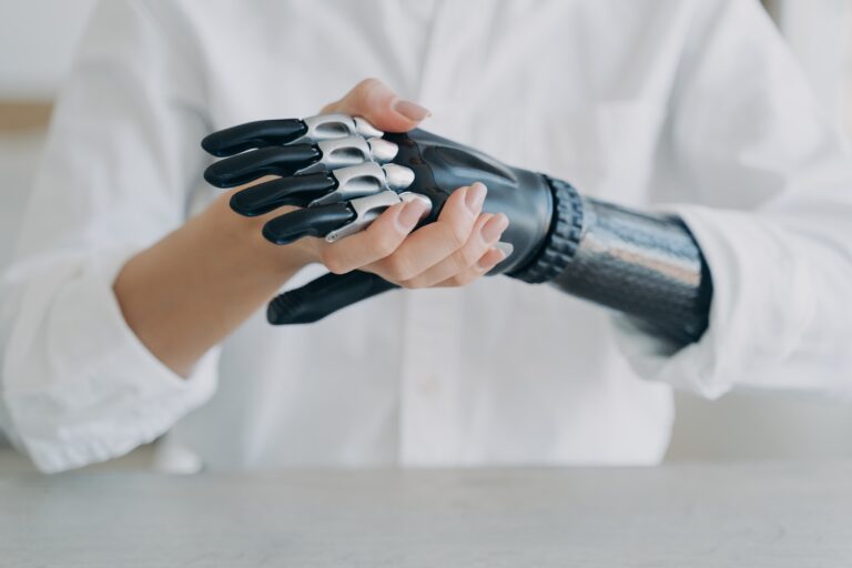 Hand and Finger Amputations in Texas Workers’ Compensation