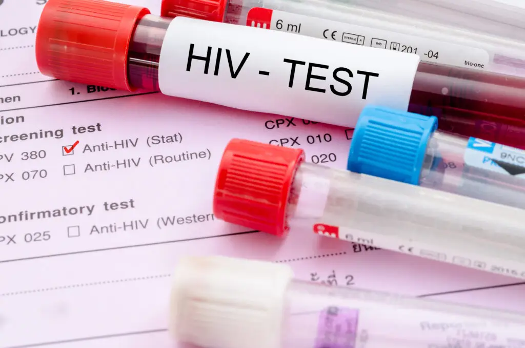 HIV and social security disability